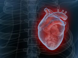 Dr. Jose Jacob-General Cardiology
