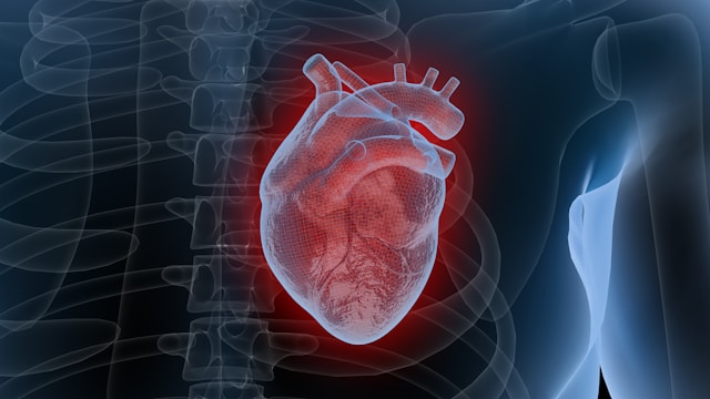 cardiac catheterization techniques