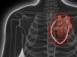 Heart Disease